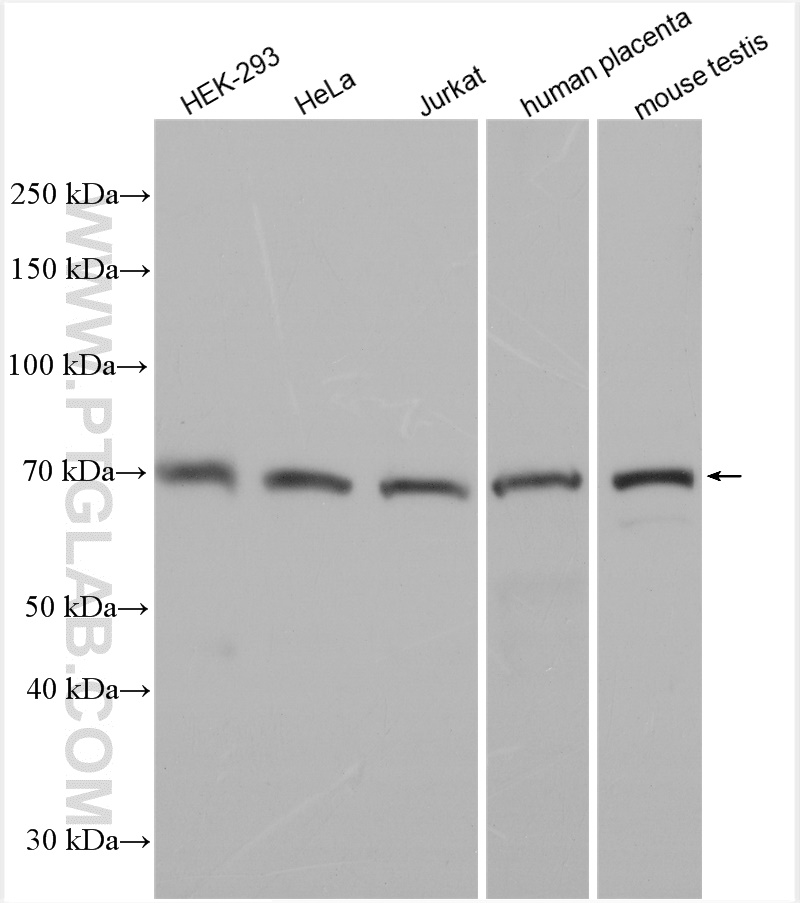 WB analysis using 30120-1-AP