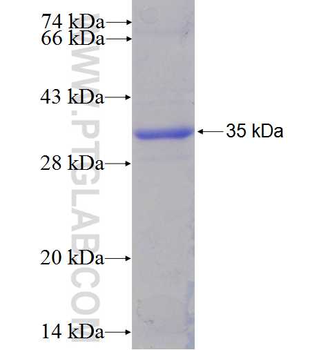 ST3GAL5 fusion protein Ag6303 SDS-PAGE