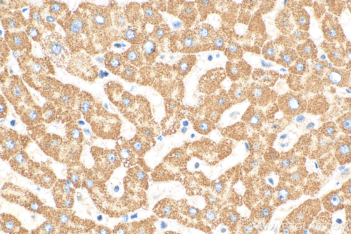 IHC staining of human liver using 13154-1-AP