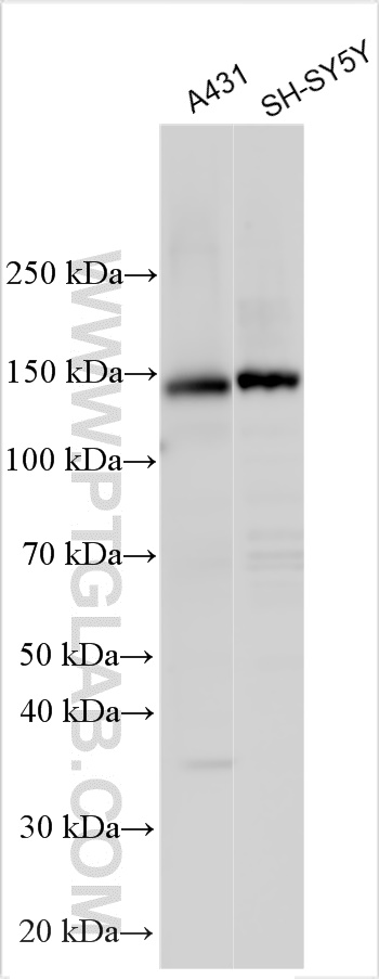 WB analysis using 30996-1-AP