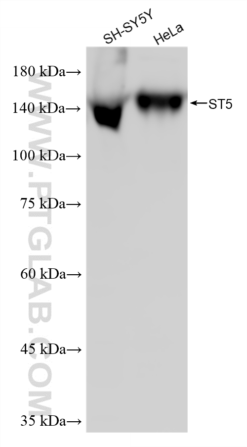 WB analysis using 87628-1-RR (same clone as 87628-1-PBS)