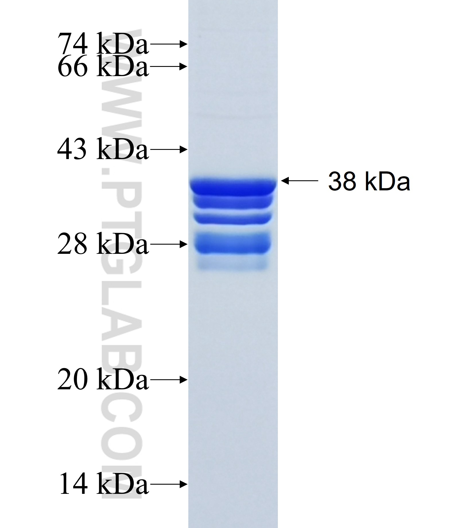 ST5 fusion protein Ag34306 SDS-PAGE