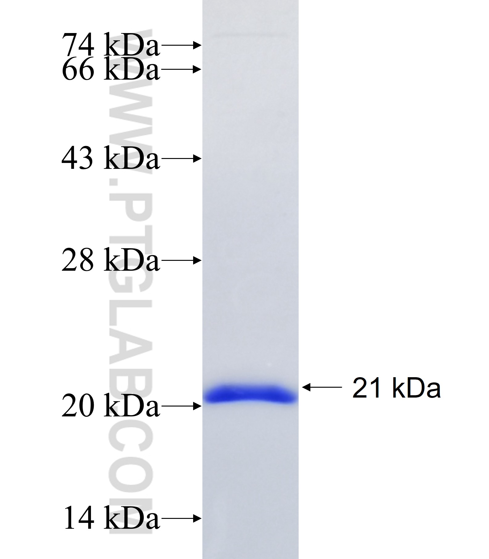 ST5 fusion protein Ag34328 SDS-PAGE