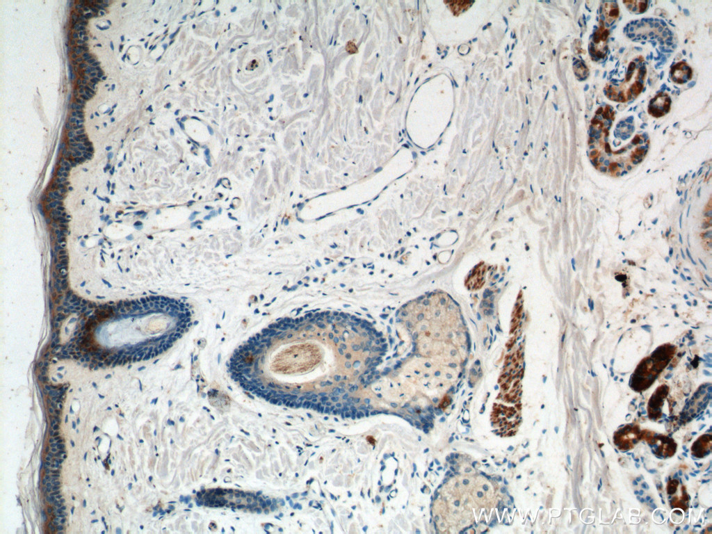 IHC staining of human skin using 14355-1-AP