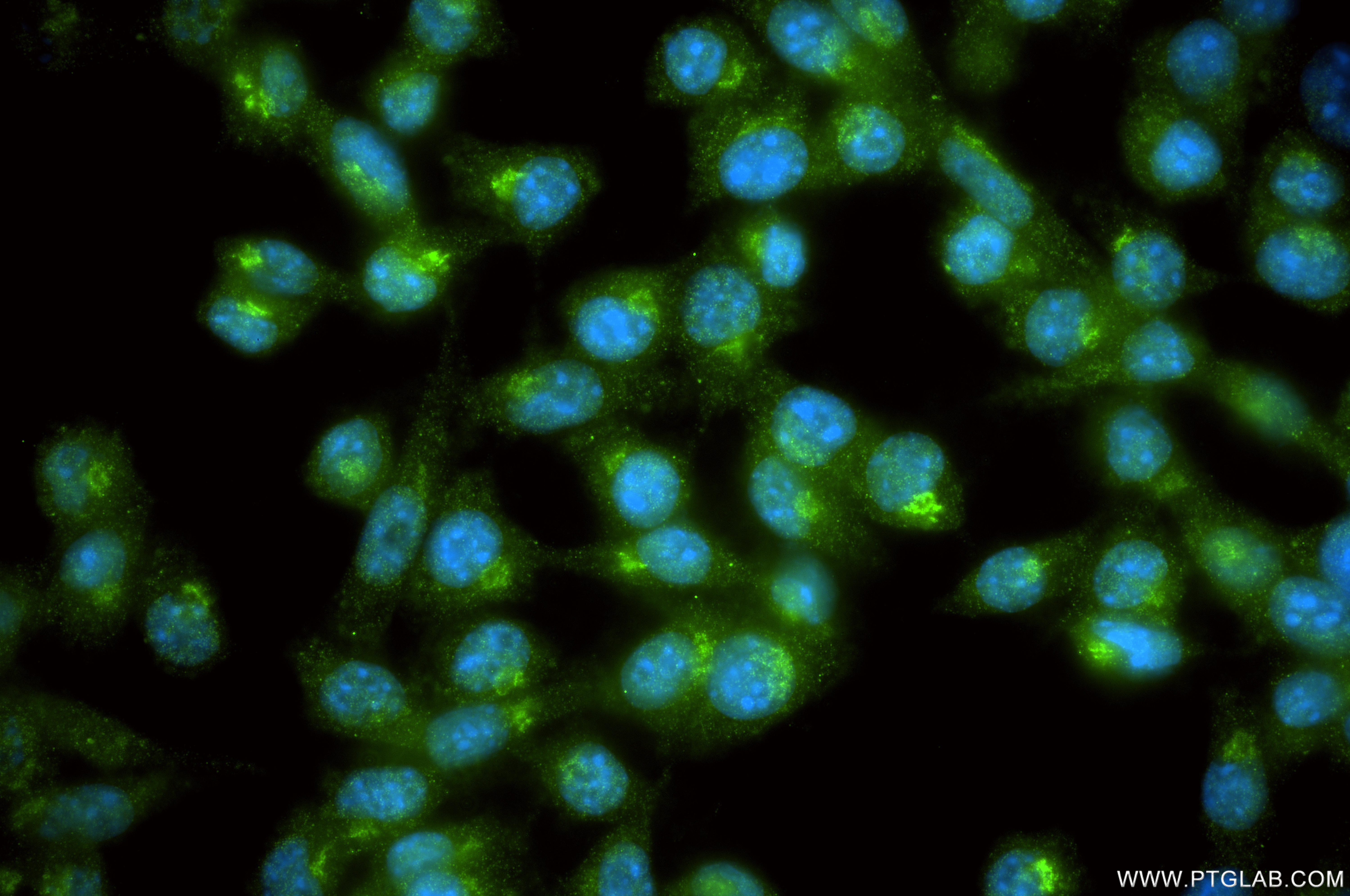 IF Staining of 4T1 using 87468-1-RR IF Staining of 4T1 using 87468-1-RR