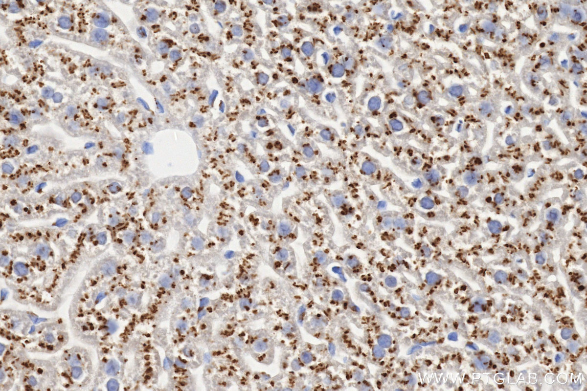 IHC staining of mouse liver using 87468-1-RR IHC staining of mouse liver using 87468-1-RR