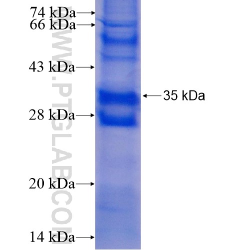 ST6GALNAC3 fusion protein Ag5189 SDS-PAGE ST6GALNAC3 fusion protein Ag5189 SDS-PAGE