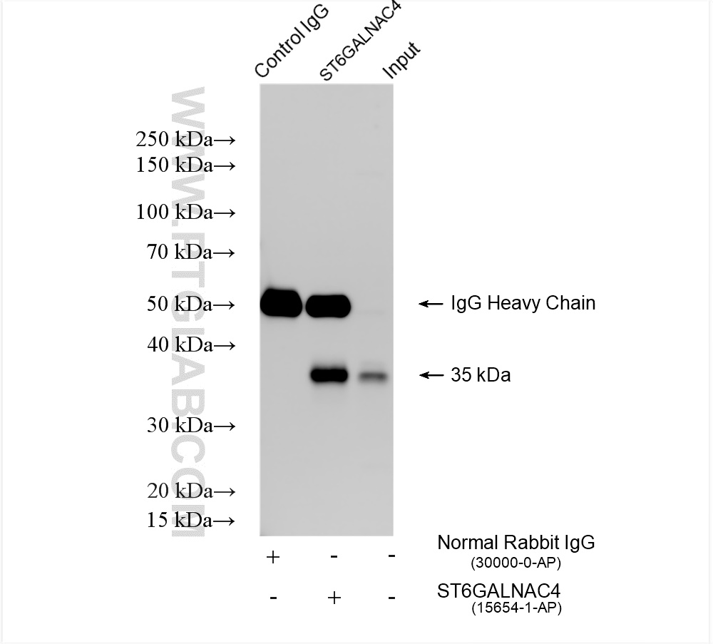 IP experiment of HeLa using 15654-1-AP