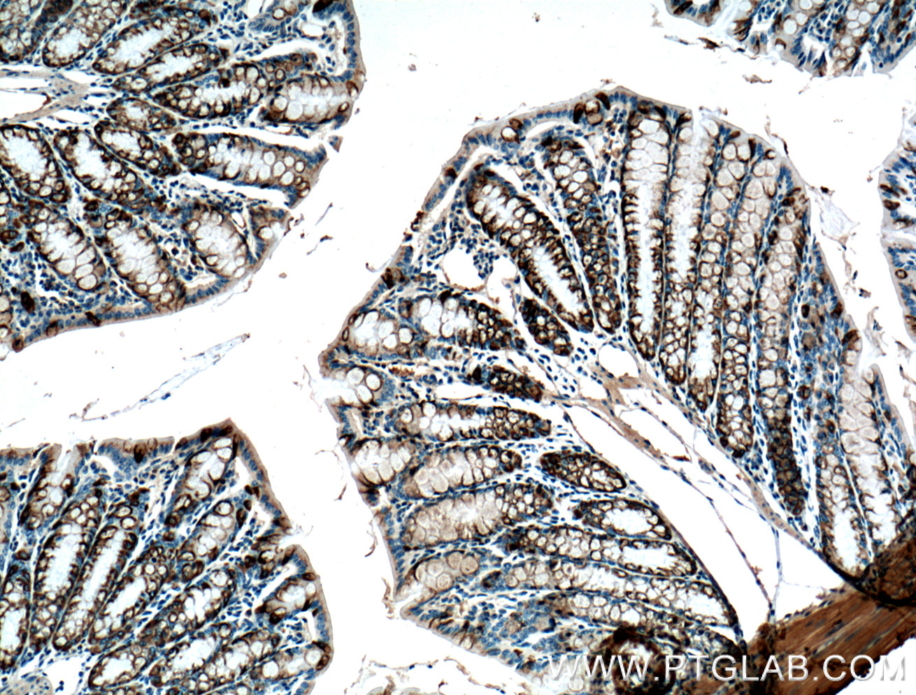 IHC staining of mouse colon using 66209-1-Ig