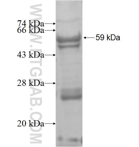 ST6GALNAC6 fusion protein Ag8475 SDS-PAGE