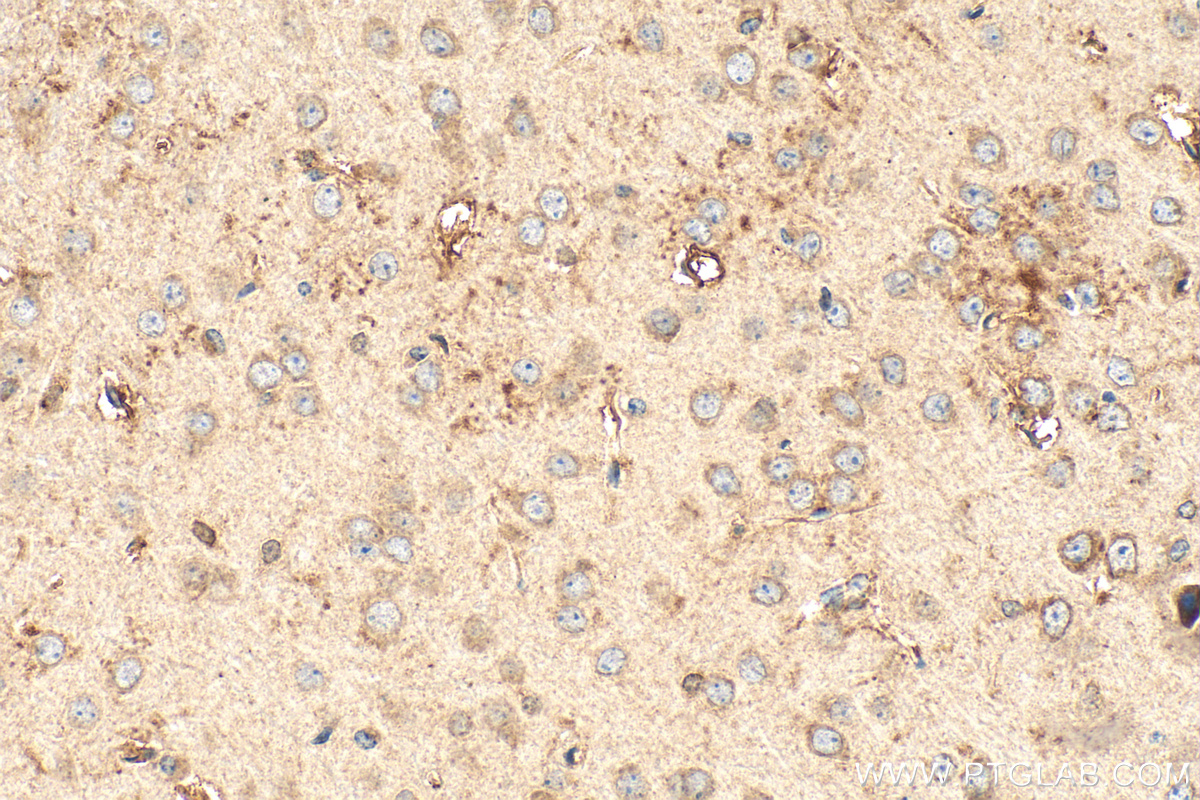 Immunohistochemical analysis of paraffin-embedded mouse brain tissue slide using <a class='green' href='/productredirect?CatalogNo=24918-1-AP' target='_blank'>24918-1-AP</a> (ST8SIA1 antibody) at dilution of 1:600 (under 40x lens). Heat mediated antigen retrieval with Tris-EDTA buffer (pH 9.0). This data was developed using the same antibody clone with 24918-1-PBS in a different storage buffer formulation. IHC staining of mouse brain using 24918-1-AP (same clone as 24918-1-PBS)