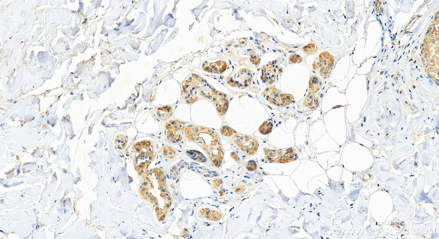 IHC staining of human paracancerous of skin cancer using 24918-1-AP