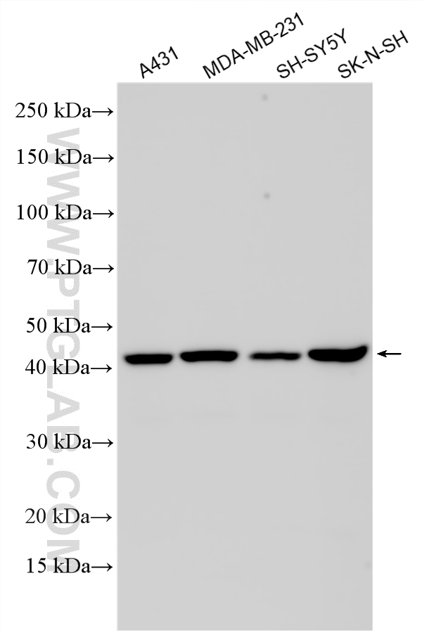 Various lysates were subjected to SDS PAGE followed by western blot with <a class='green' href='/productredirect?CatalogNo=24918-1-AP' target='_blank'>24918-1-AP</a> (ST8SIA1 antibody) at dilution of 1:4000 incubated at room temperature for 1.5 hours. This data was developed using the same antibody clone with 24918-1-PBS in a different storage buffer formulation. WB analysis using 24918-1-AP (same clone as 24918-1-PBS)
