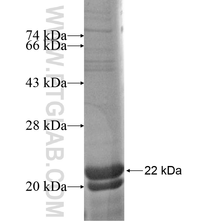ST8SIA5 fusion protein Ag16557 SDS-PAGE ST8SIA5 fusion protein Ag16557 SDS-PAGE