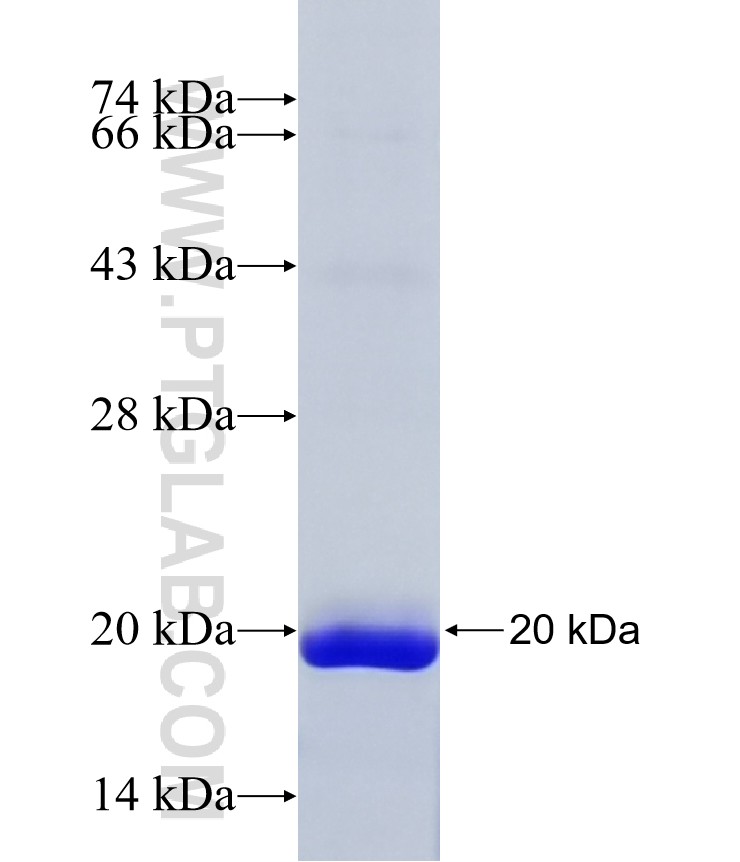 STAB2 fusion protein Ag35346 SDS-PAGE STAB2 fusion protein Ag35346 SDS-PAGE