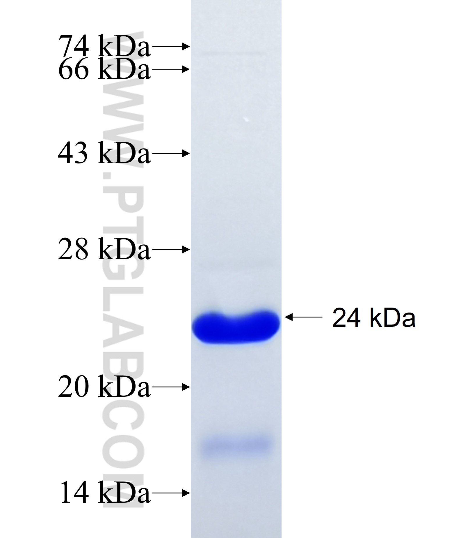 STAC2 fusion protein Ag17976 SDS-PAGE