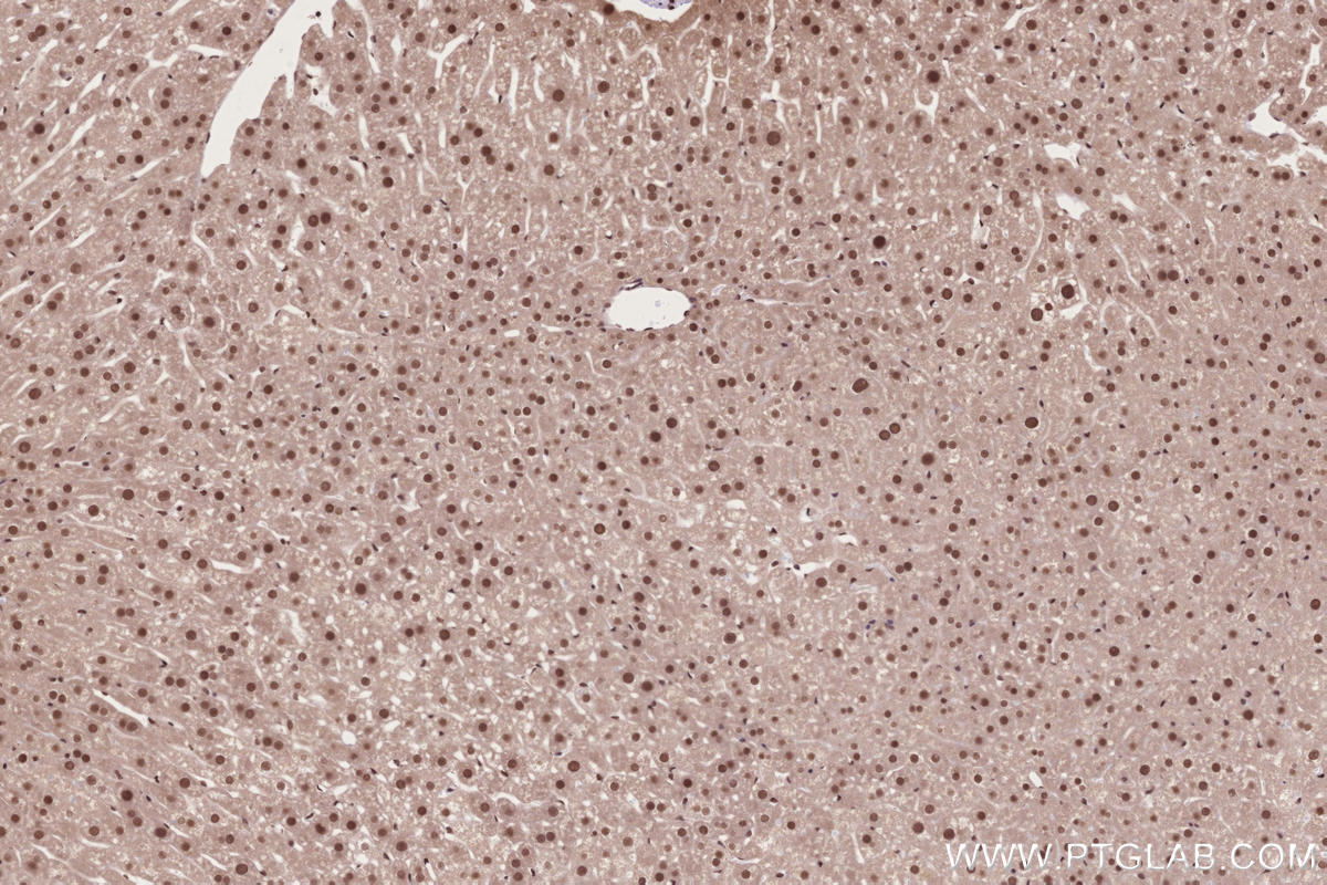 IHC staining of mouse liver using 14015-1-AP