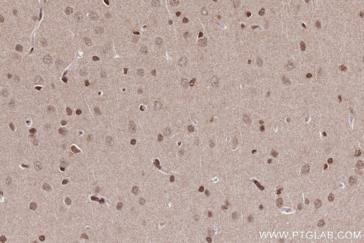 IHC staining of rat brain using 14015-1-AP