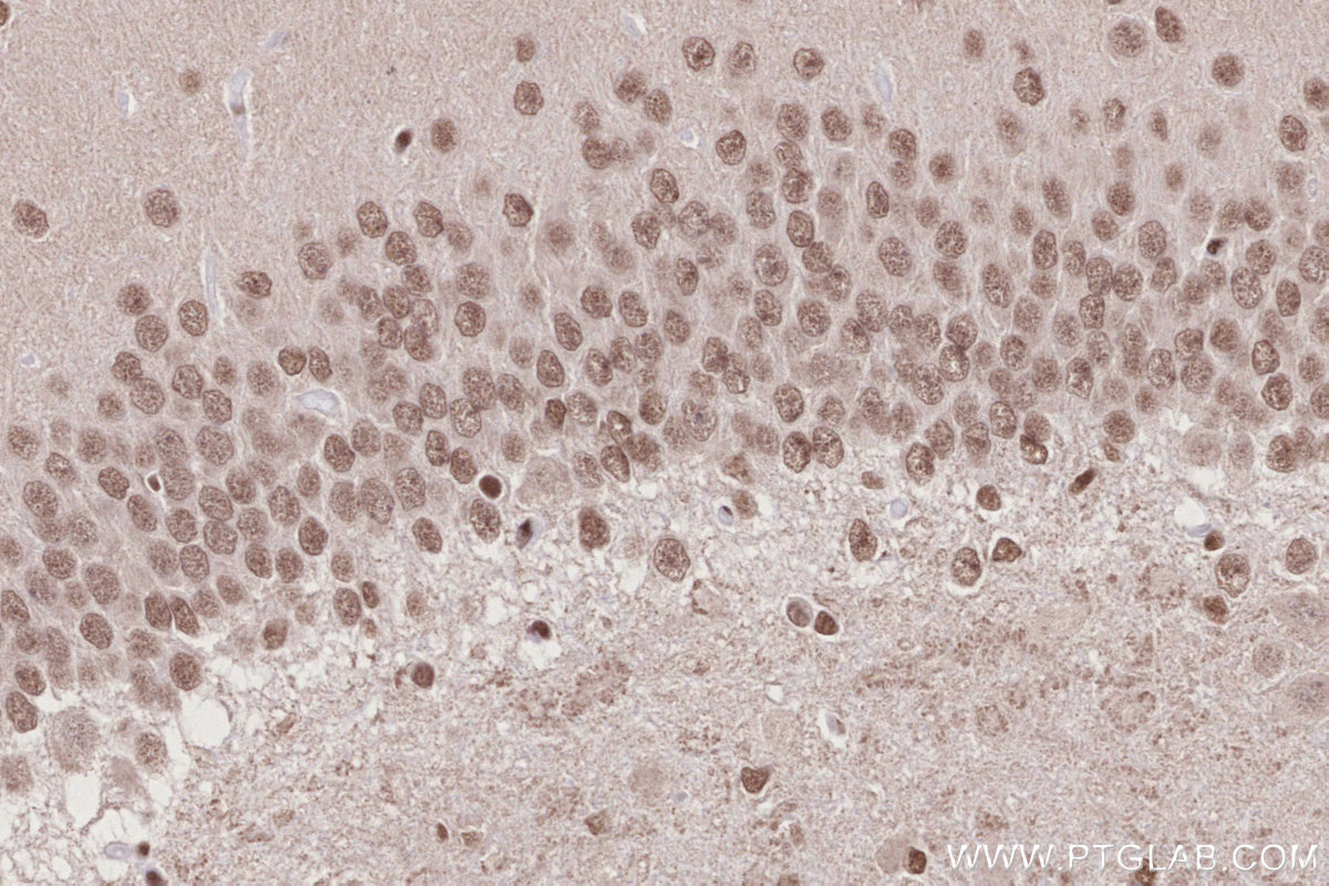 IHC staining of rat brain using 14015-1-AP