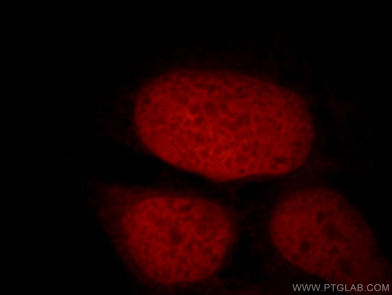 IF Staining of HEK-293 using 19837-1-AP