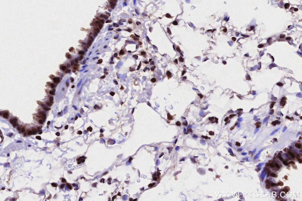 IHC staining of rat lung using 19837-1-AP IHC staining of rat lung using 19837-1-AP