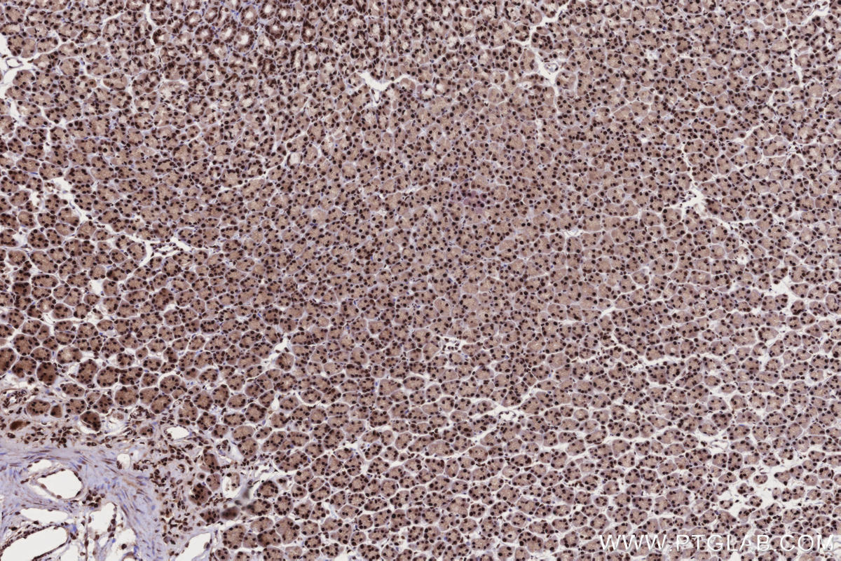 IHC staining of rat stomach using 19837-1-AP IHC staining of rat stomach using 19837-1-AP