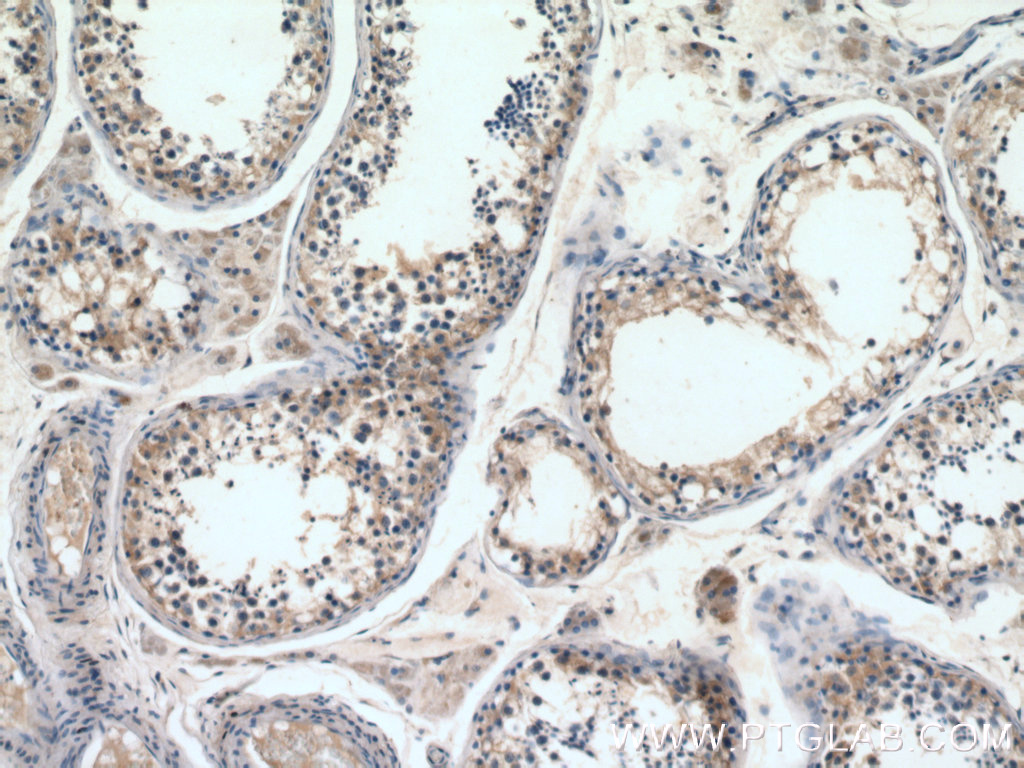 IHC staining of human testis using 12434-1-AP