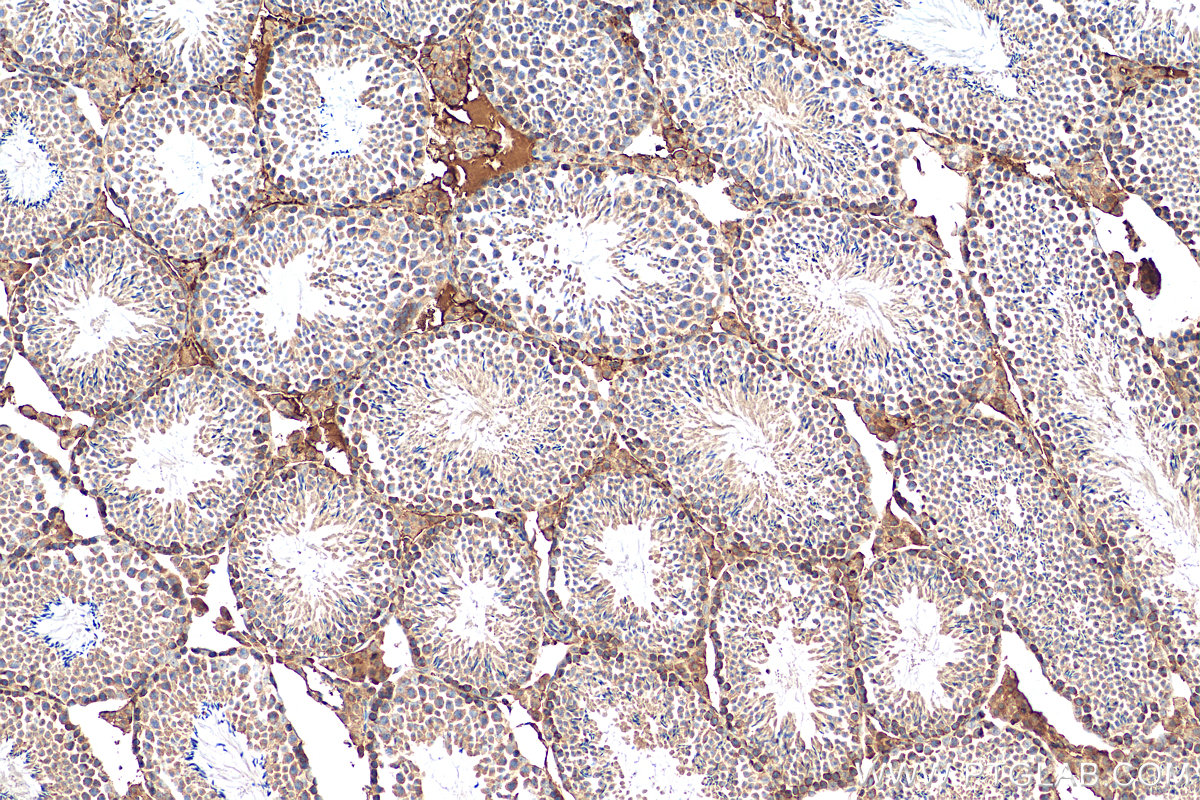 IHC staining of mouse testis using 12434-1-AP