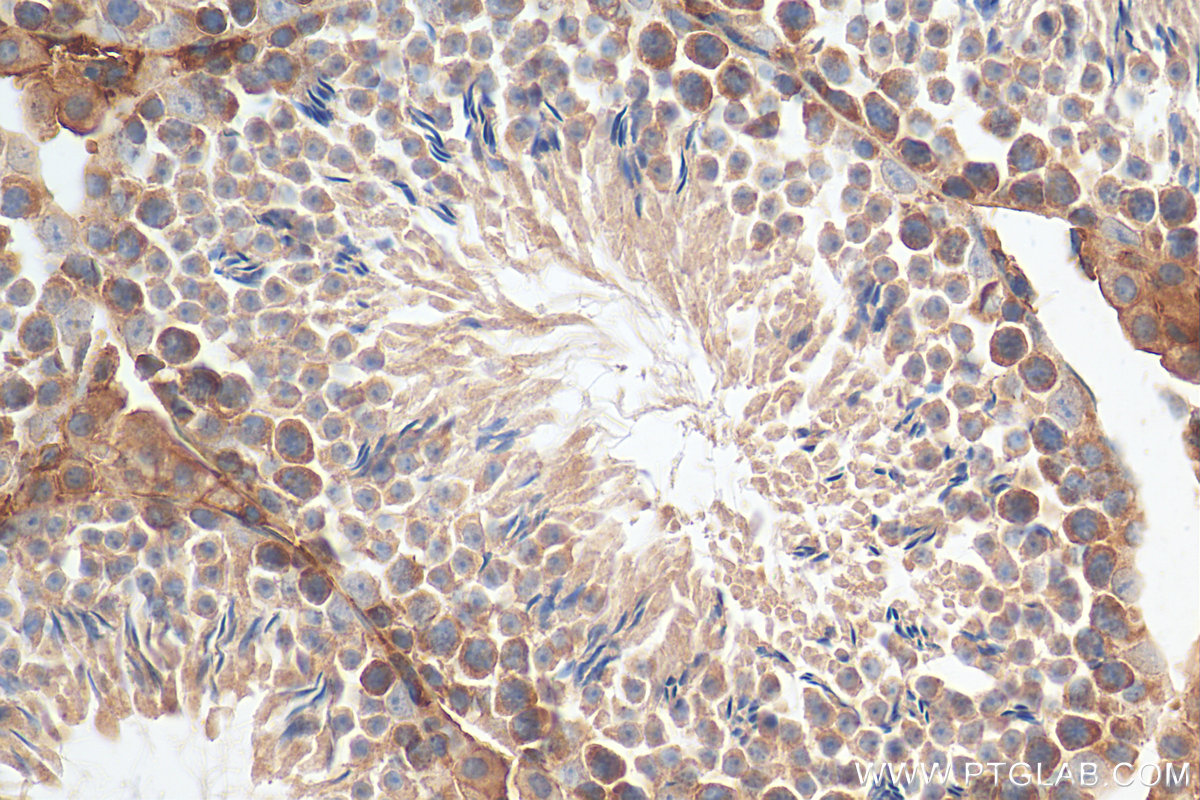 IHC staining of mouse testis using 12434-1-AP