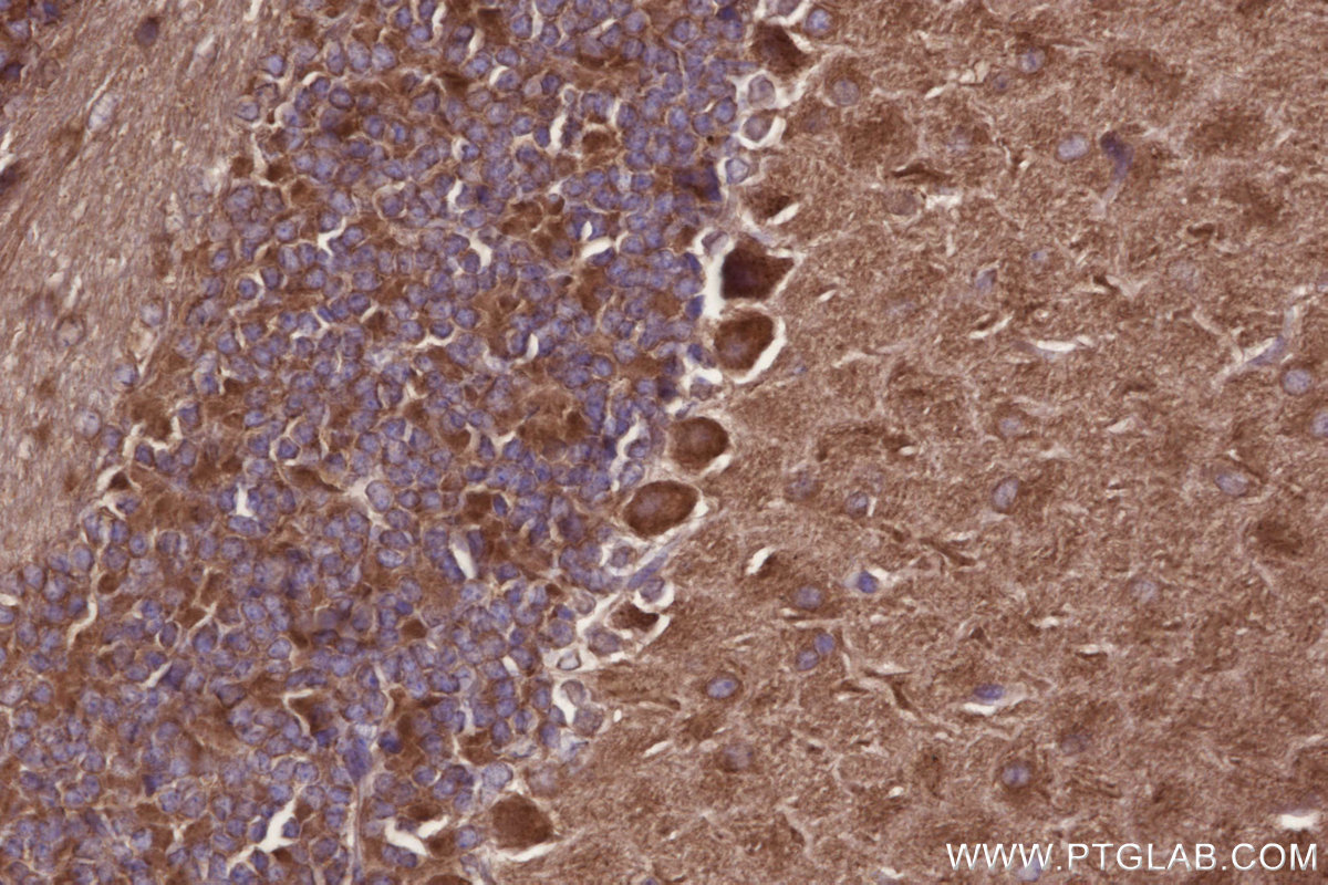 IHC staining of mouse cerebellum using 12434-1-AP IHC staining of mouse cerebellum using 12434-1-AP