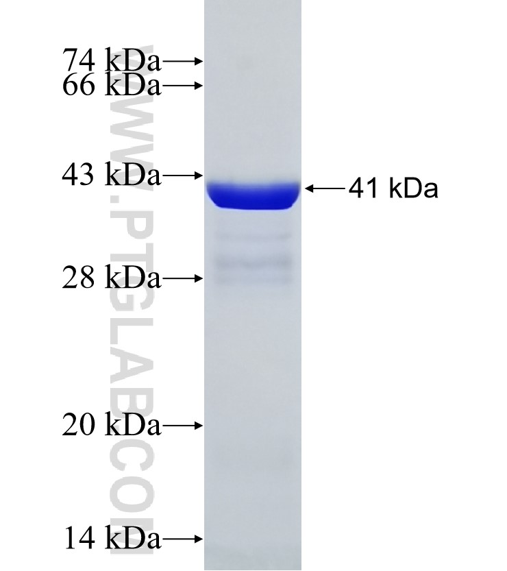 STAM2 fusion protein Ag31862 SDS-PAGE