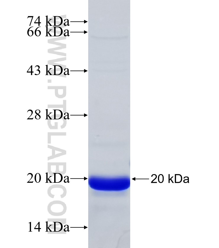 STAM2 fusion protein Ag31874 SDS-PAGE STAM2 fusion protein Ag31874 SDS-PAGE