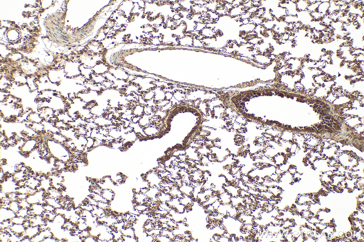 Immunohistochemical analysis of paraffin-embedded rat lung tissue slide using 11346-1-AP (STAMBP antibody) at dilution of 1:200 (under 10x lens). Heat mediated antigen retrieval with Tris-EDTA buffer (pH 9.0). IHC staining of rat lung using 11346-1-AP
