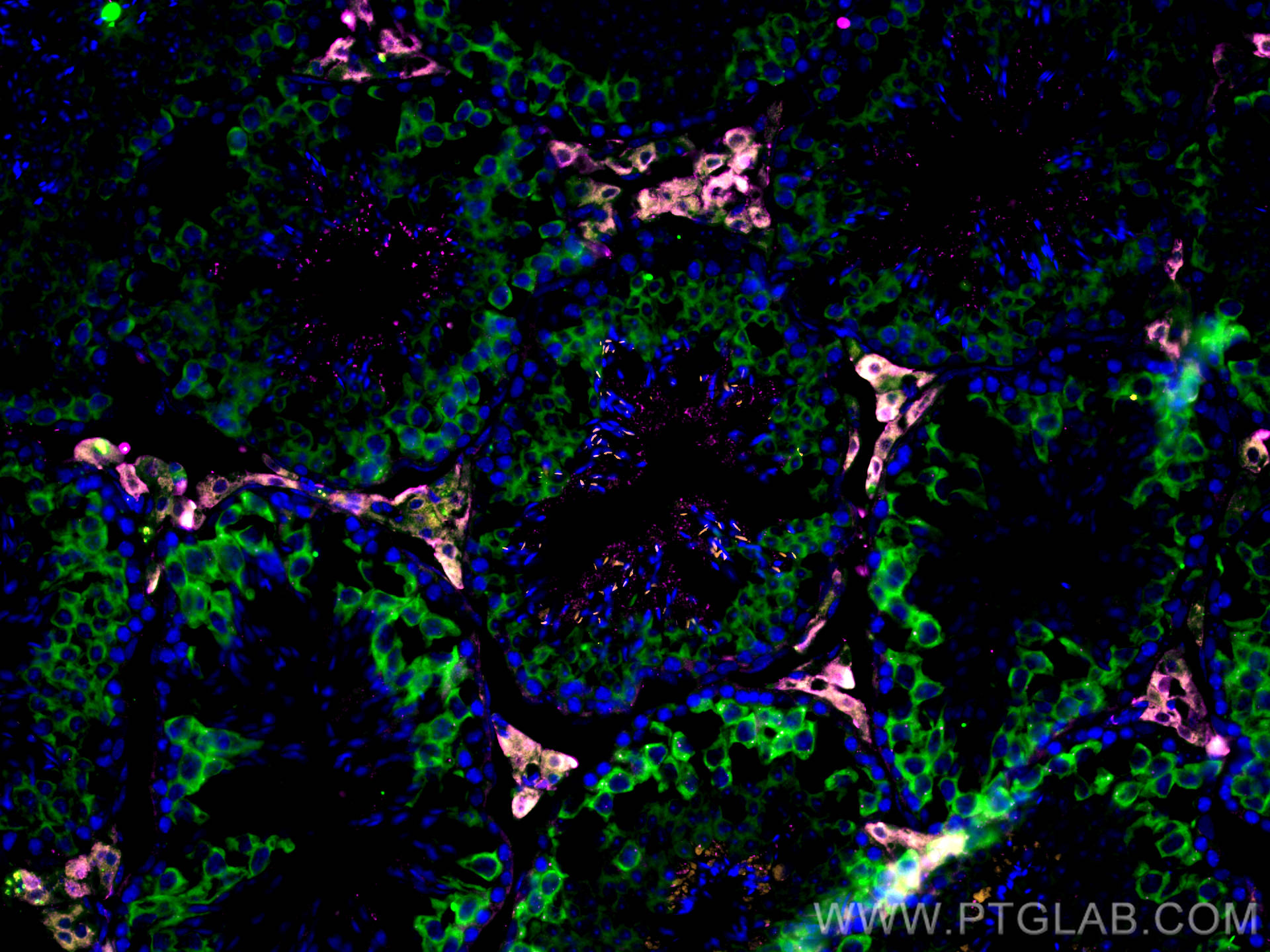 IF Staining of mouse testis using 12225-1-AP