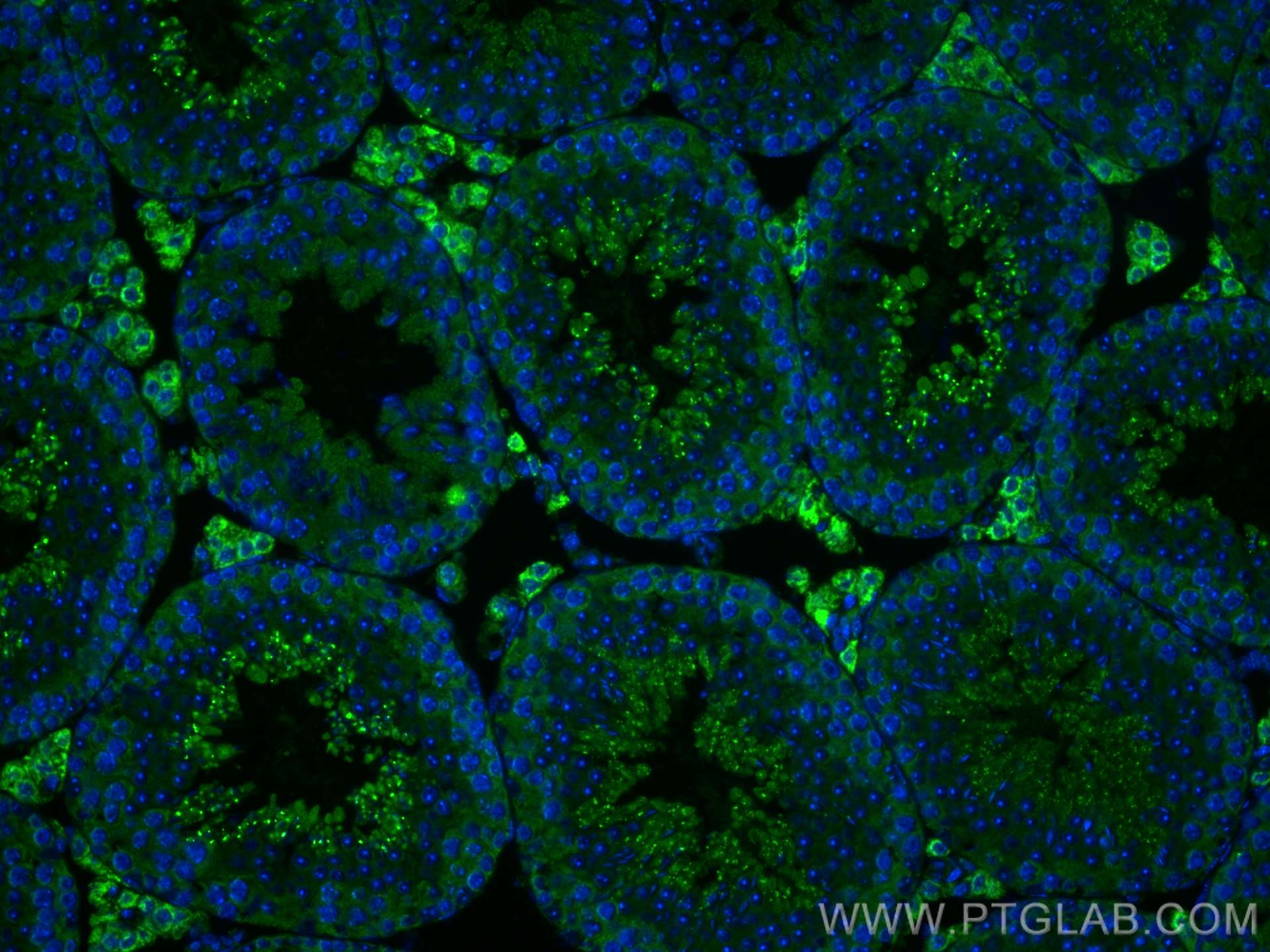 IF Staining of mouse testis using 12225-1-AP