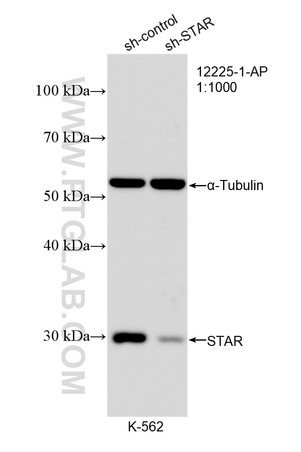 WB analysis of K-562 using 12225-1-AP