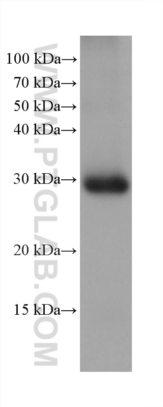 WB analysis of human adrenal gland using 67130-1-Ig