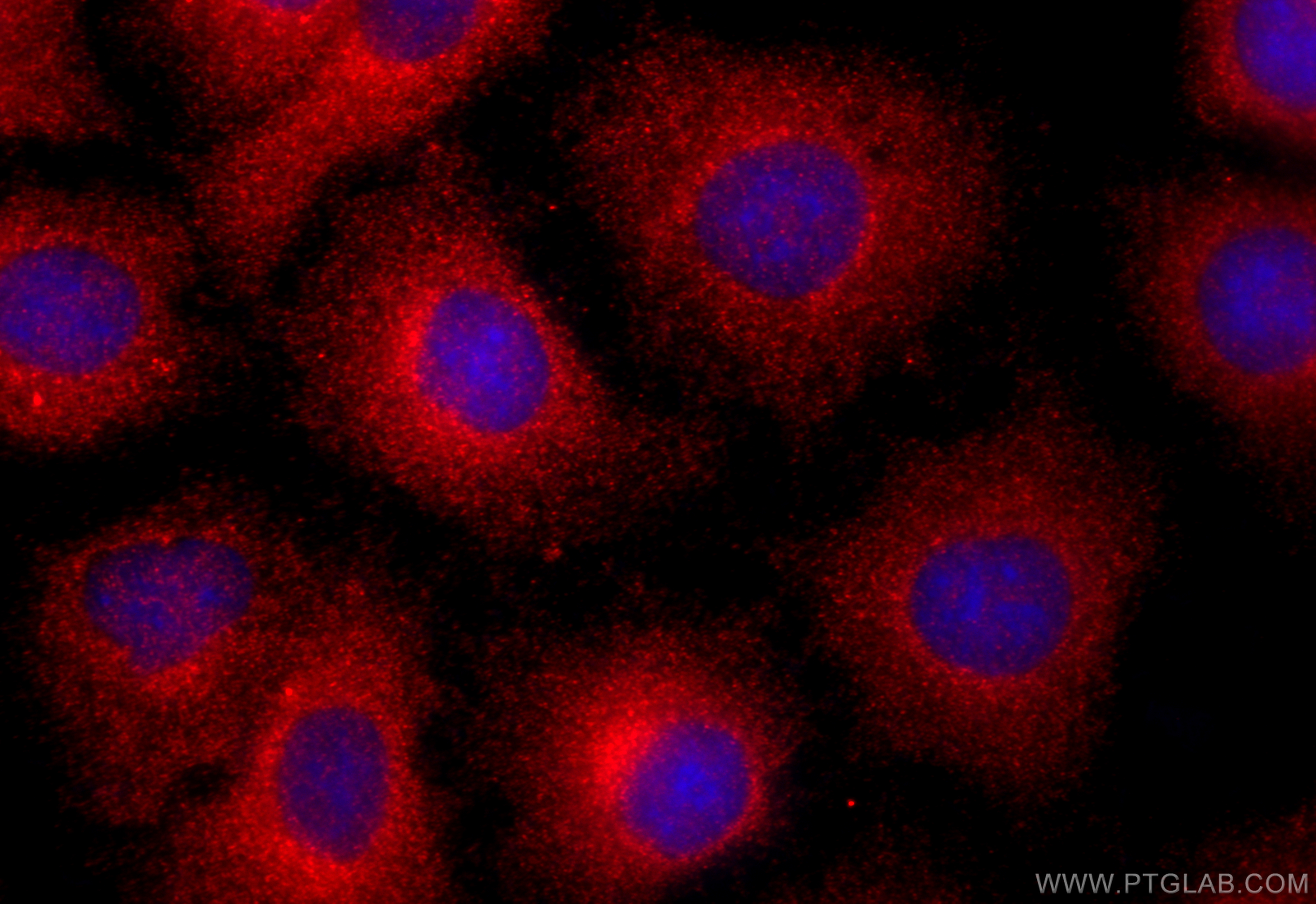 IF Staining of A549 using 21325-1-AP