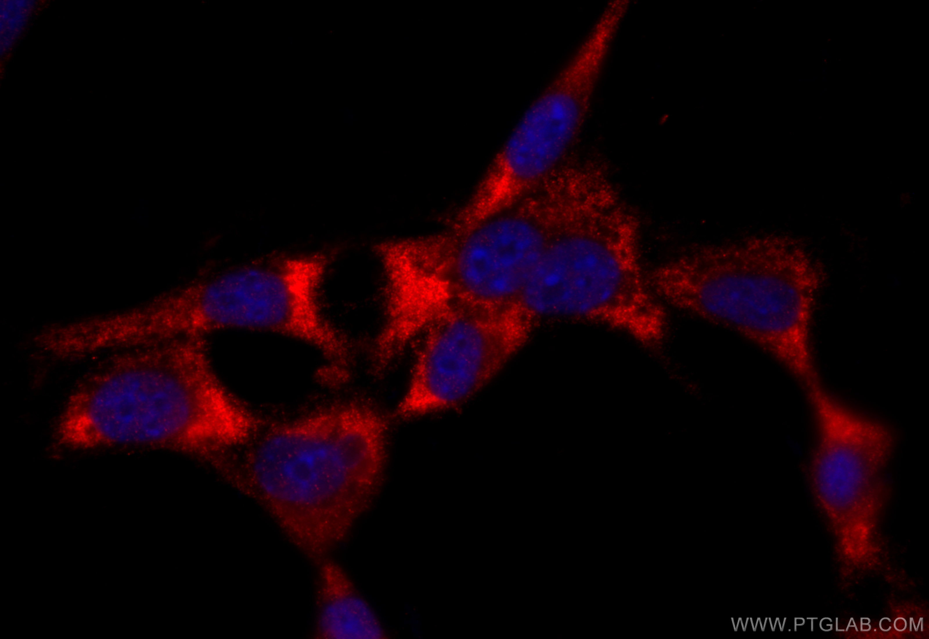 IF Staining of NIH/3T3 using 21325-1-AP