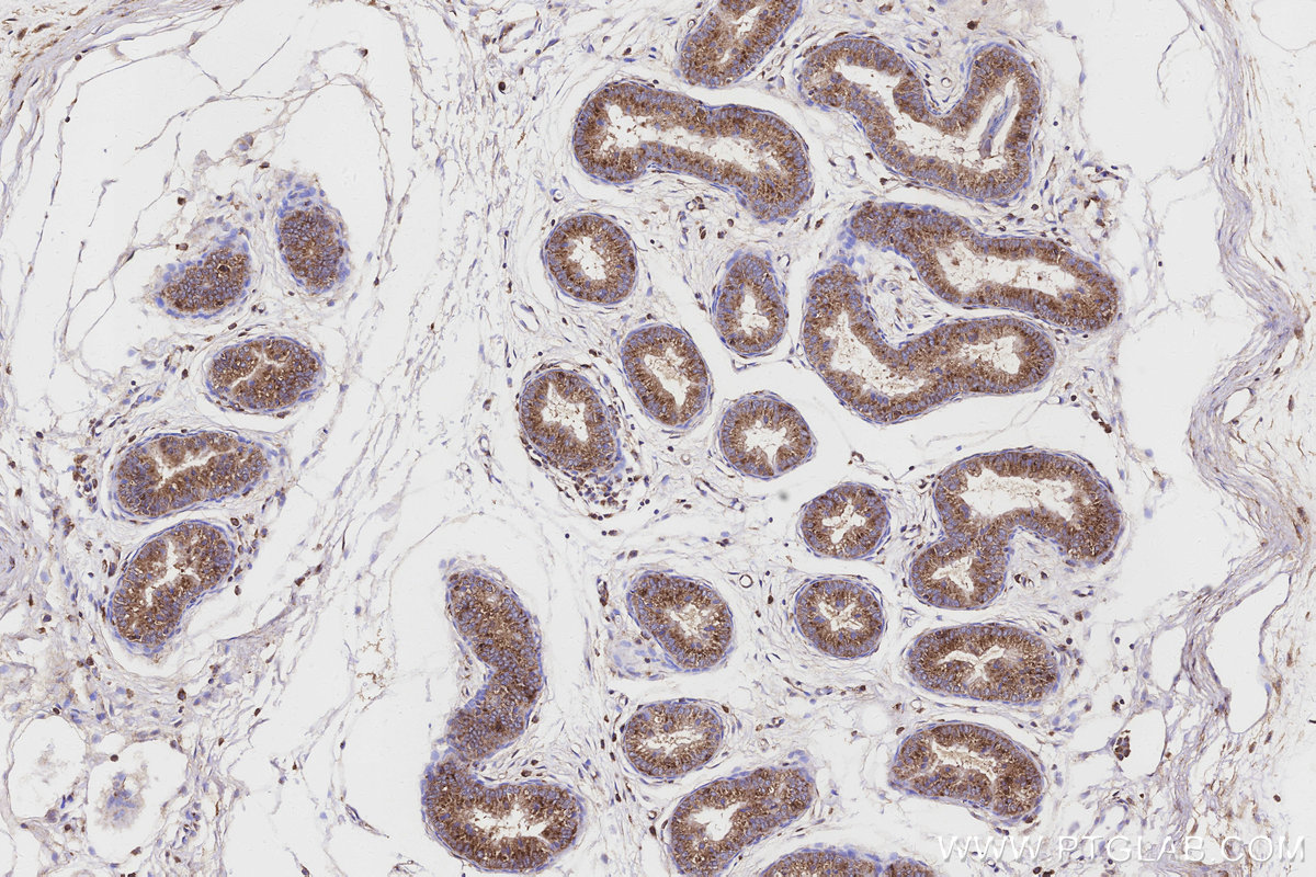 IHC staining of rat epididymis using 20502-1-AP IHC staining of rat epididymis using 20502-1-AP