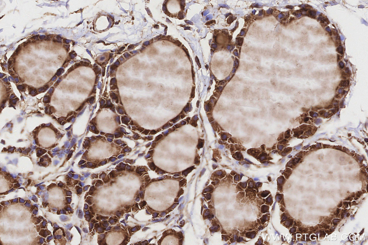 IHC staining of rat thyroid gland using 20502-1-AP IHC staining of rat thyroid gland using 20502-1-AP