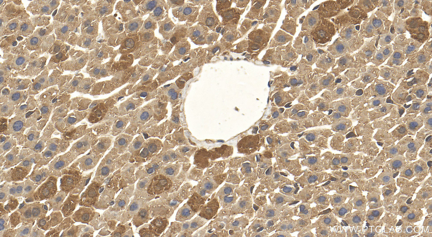 IHC staining of mouse liver using 10487-1-AP