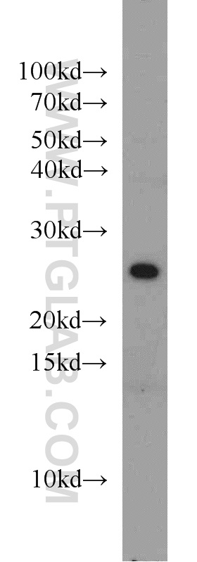 WB analysis of mouse liver using 10487-1-AP