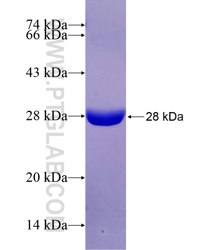 STARD5 fusion protein Ag29618 SDS-PAGE STARD5 fusion protein Ag29618 SDS-PAGE