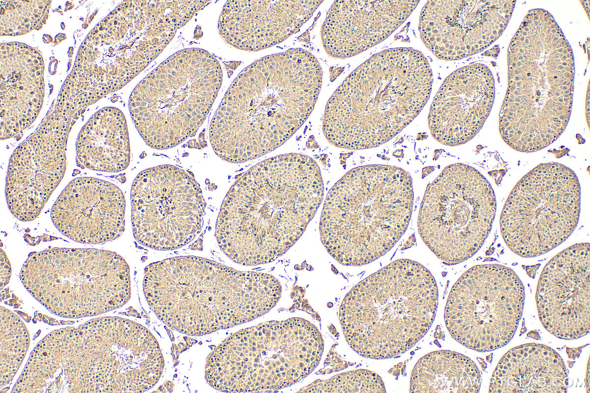 IHC staining of mouse testis using 15689-1-AP