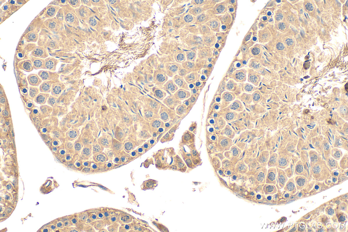 IHC staining of mouse testis using 15689-1-AP