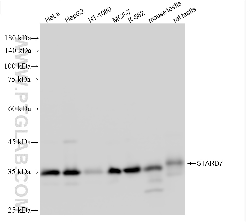 WB analysis using 85131-4-RR