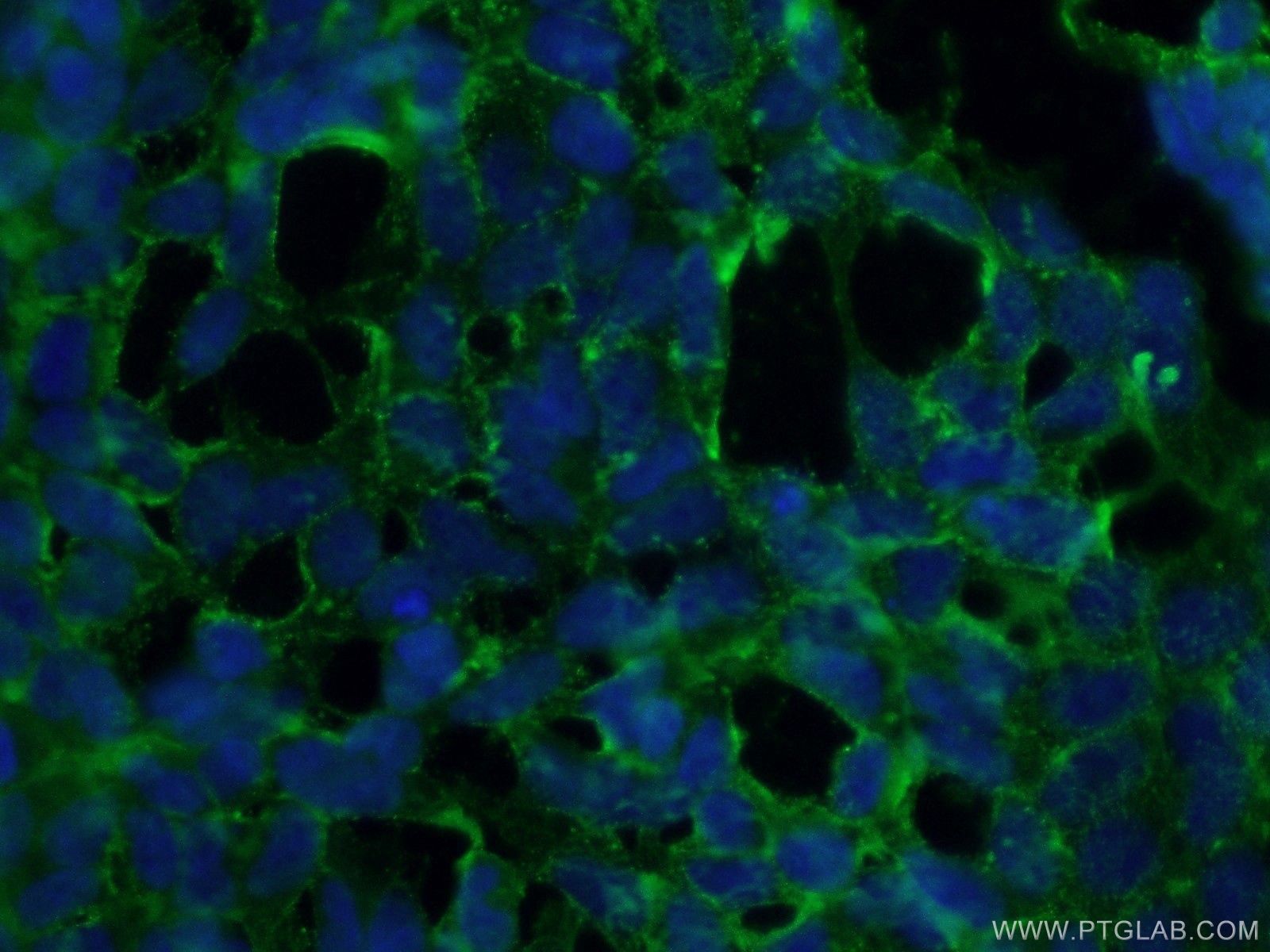 IF Staining of HEK-293 using 13899-1-AP