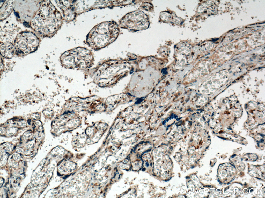 IHC staining of human placenta using 13899-1-AP