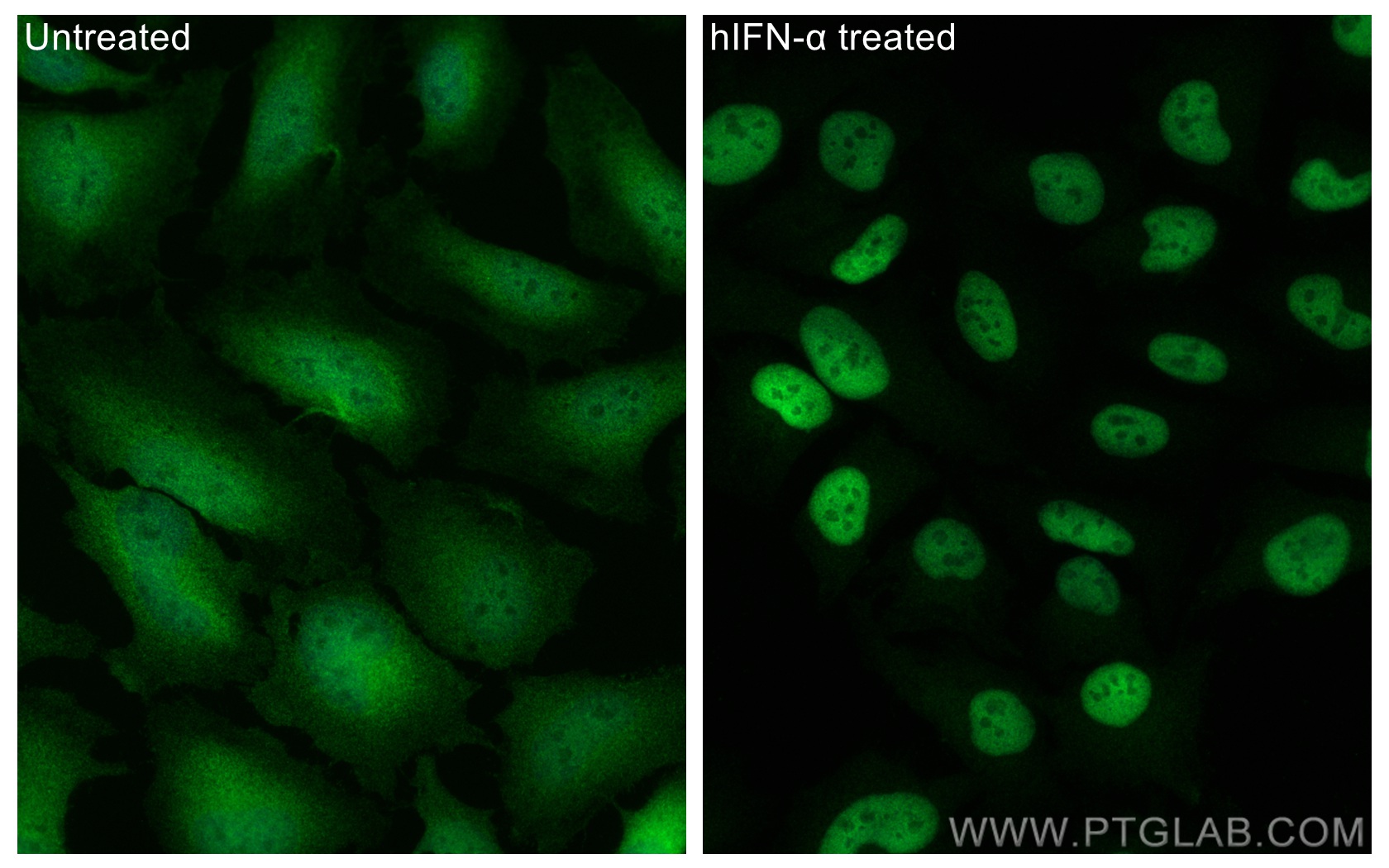 IF Staining of HeLa using 82016-1-RR